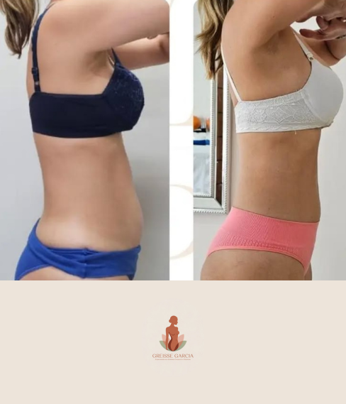 antes e depois Greisse Garcia (2)