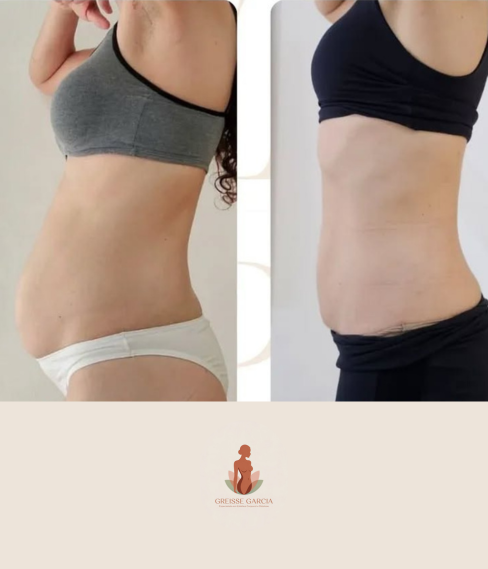 antes e depois Greisse Garcia (3)