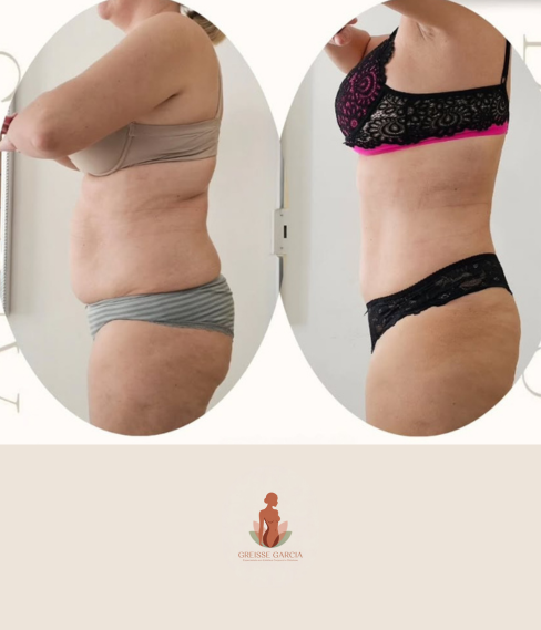 antes e depois Greisse Garcia (4)