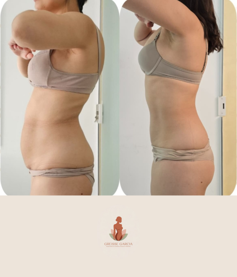antes e depois Greisse Garcia (5)