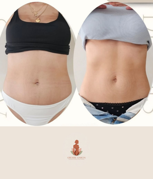 antes e depois Greisse Garcia (7)