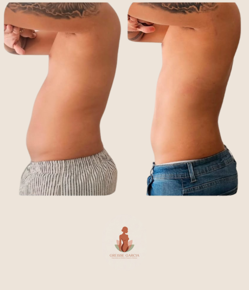 antes e depois Greisse Garcia (8)